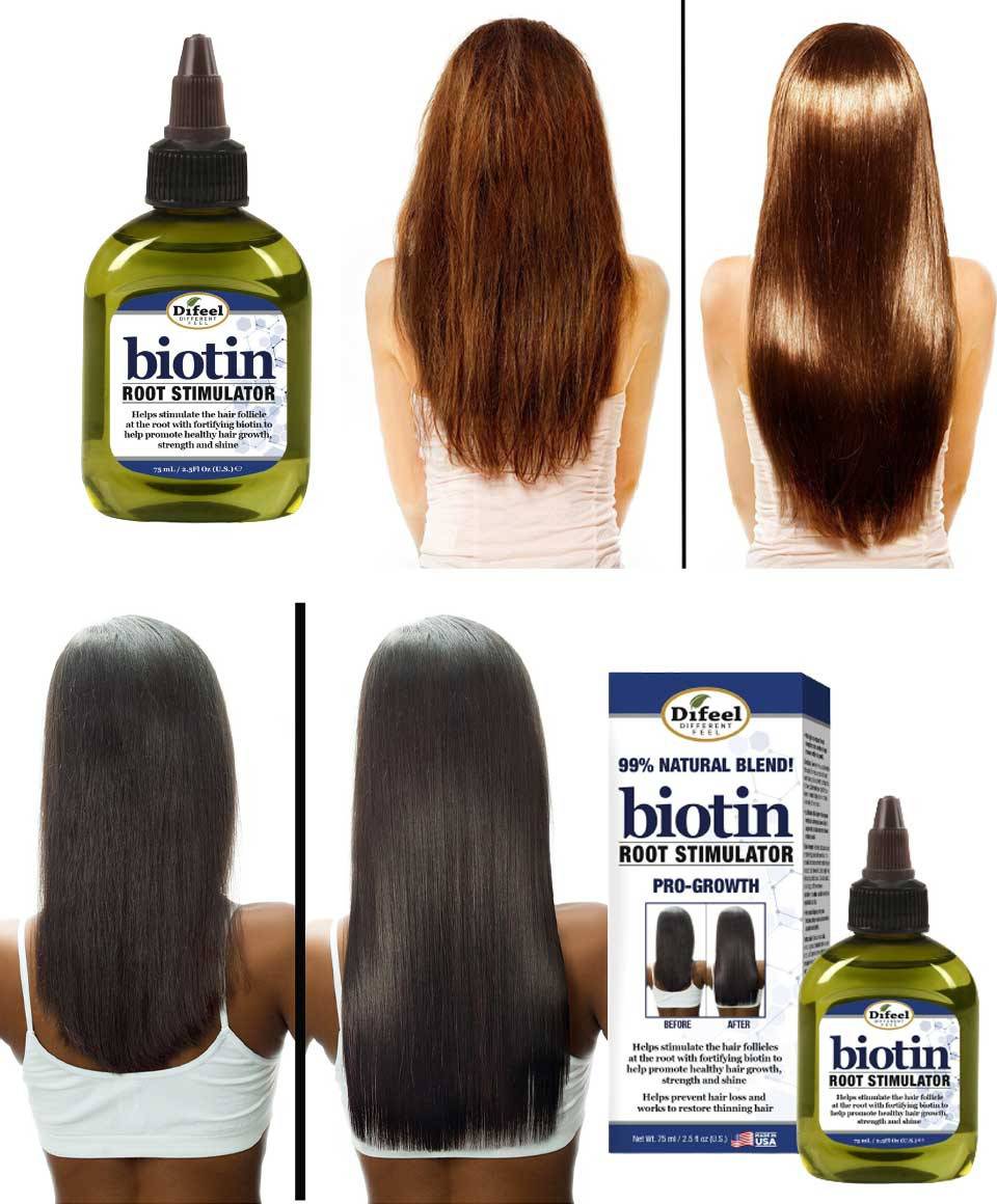 Difeel Natural Blend Biotin Root Stimulator hair treatment bottle with applicator tip for scalp nourishment and hair growth.