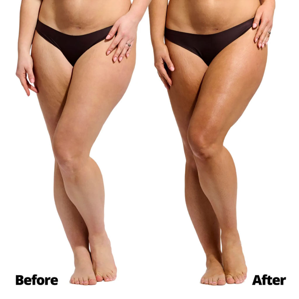 Skinny Tan Self Tanning Mousse Medium