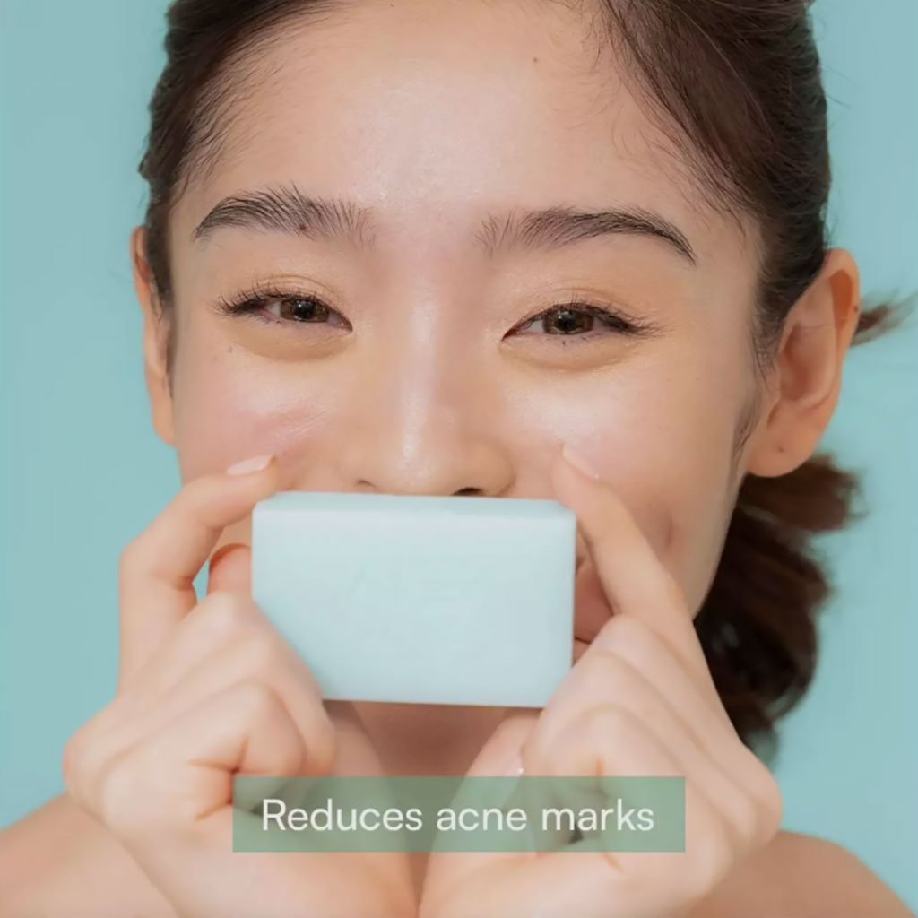 Seoul White Bye Bye Acne Soap