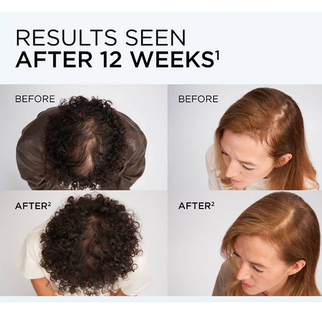 Loreal Elvive Growth Booster Anti Fall Conditioner