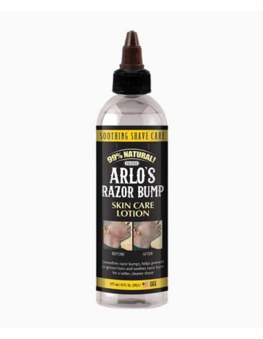 Arlos Razor Bump Skin Care Lotion