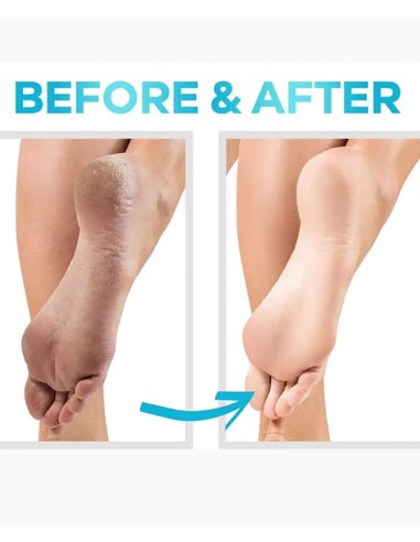 Cerave SA Renewing Foot Cream