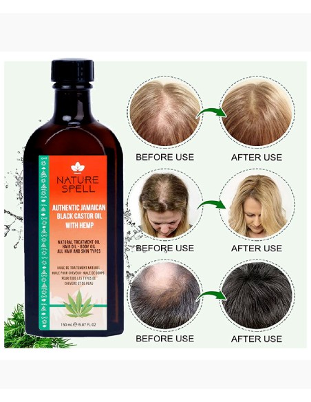 Nature Spell Authentic Jamaican Black Castor Oil With Hemp Nature Spell Authentic Jamaican Black Castor Oil With Hemp