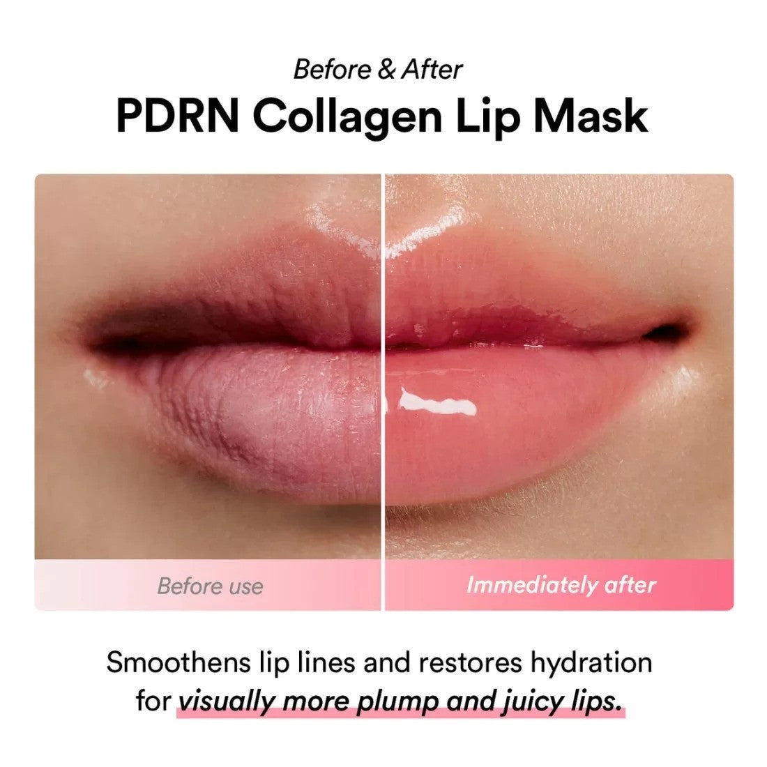 Abib PDRN Collagen Glazed Jelly Lip Mask