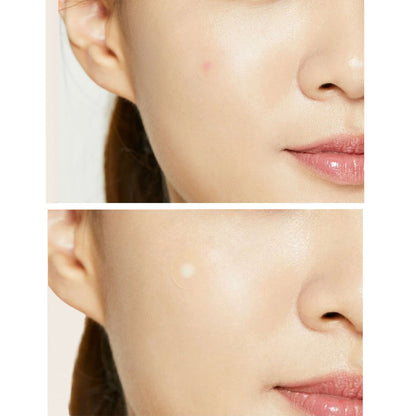 Face Facts  Blemish Patches
