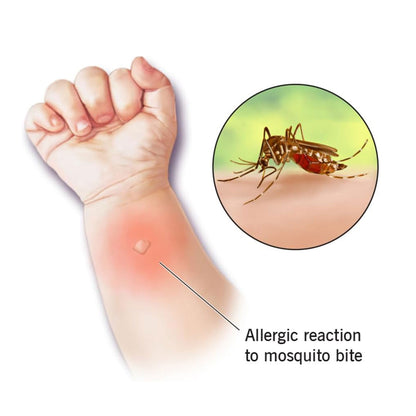 Nuage Pestshield Mosquito And Insect Repellent Kids Spray Pen