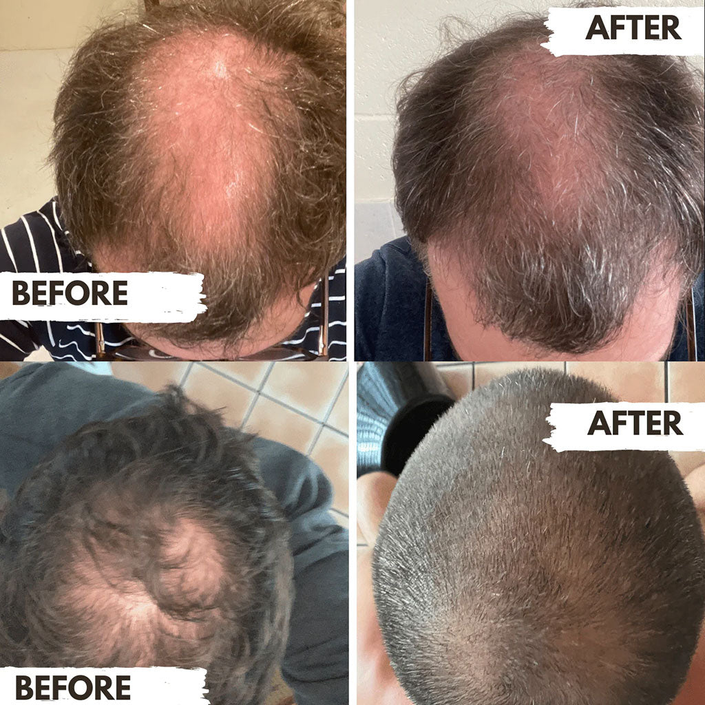 Regrow  Conditioner For Men