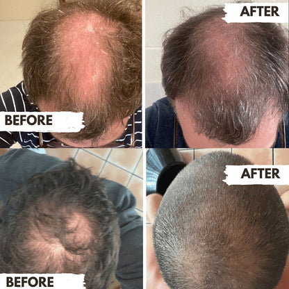 Regrow  Conditioner For Men