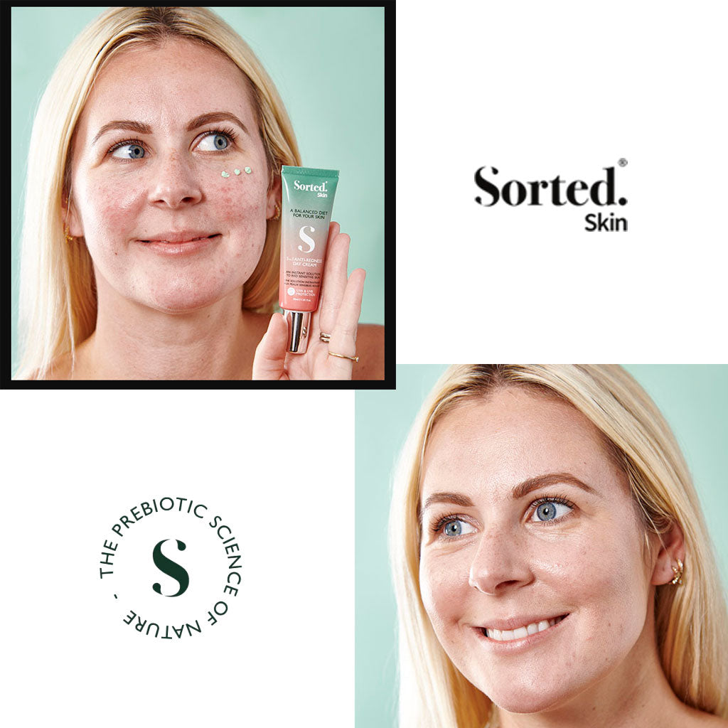 Sorted Skin 5 In 1 Anti Redness Day Cream
