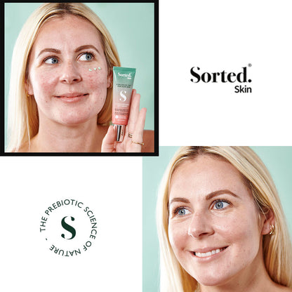 Sorted Skin 5 In 1 Anti Redness Day Cream